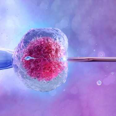 What is IVF (In Vitro Fertilization)?